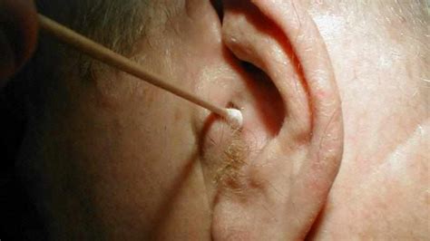 Как использовать мазь при отите - эффективное лечение для ушного заболевания